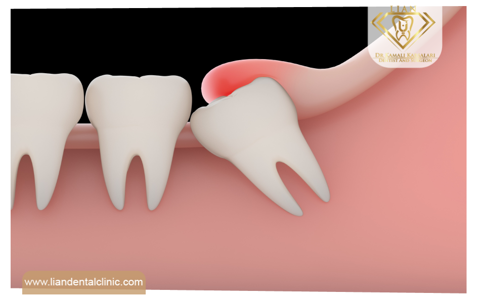 کلینیک دندانپزشکی لیان شهریار 