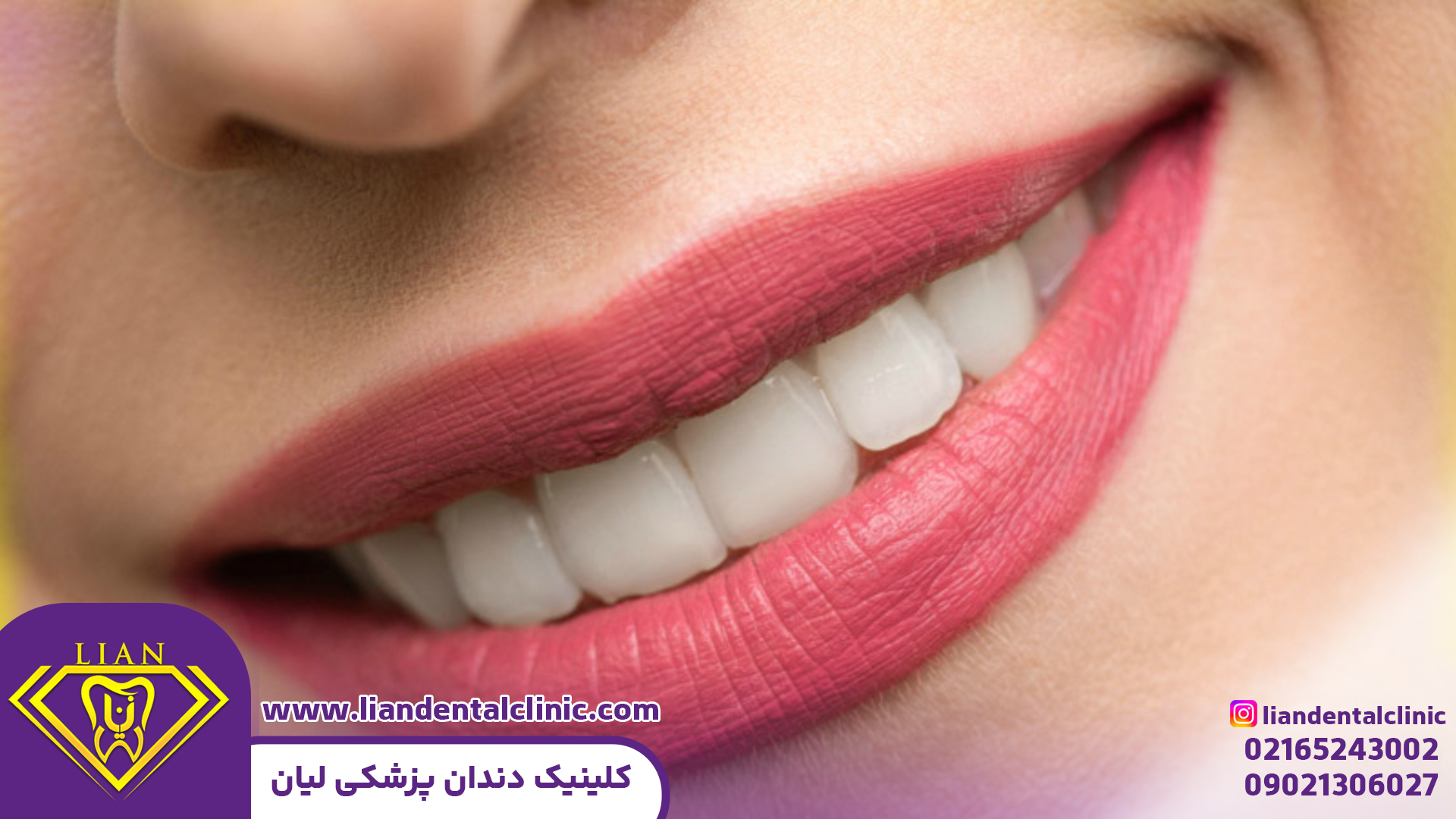 دندانپزشکی زیبایی