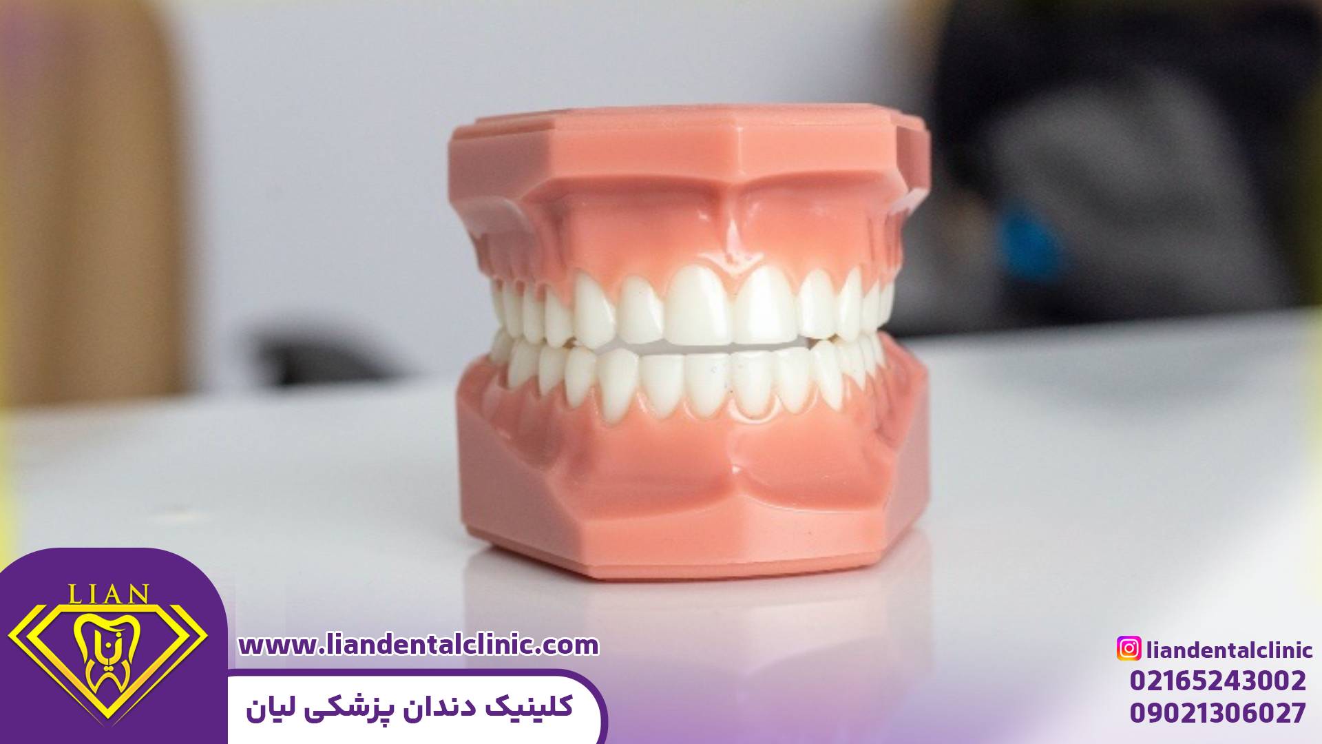دندان مصنوعی