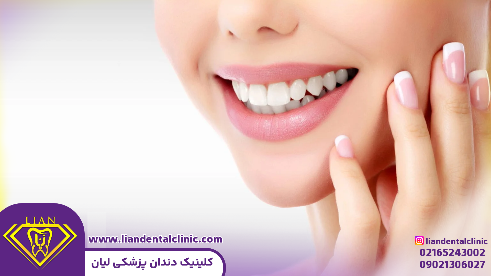 دندانپزشکی زیبایی