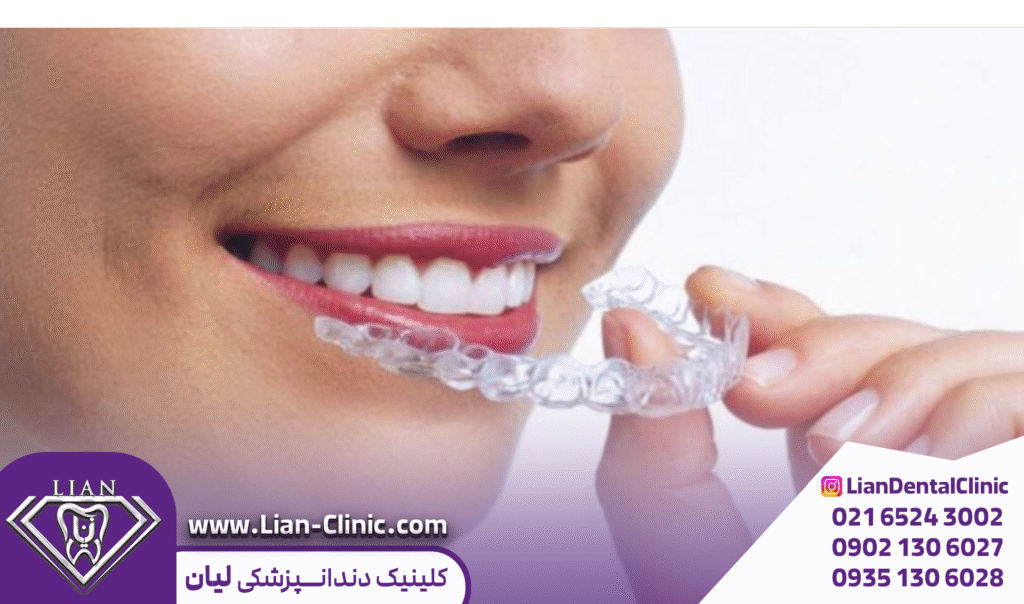 ارتودنسی نامرئی شهریار
