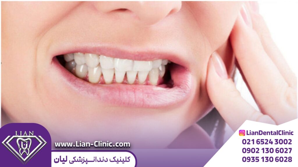 اجتناب از فشار دادن دندانها