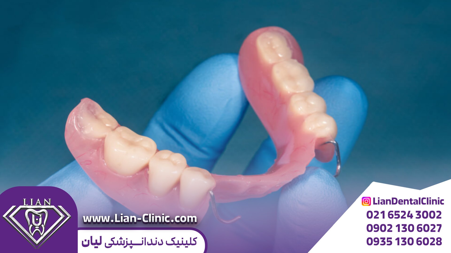 پروتز متحرک در شهریار